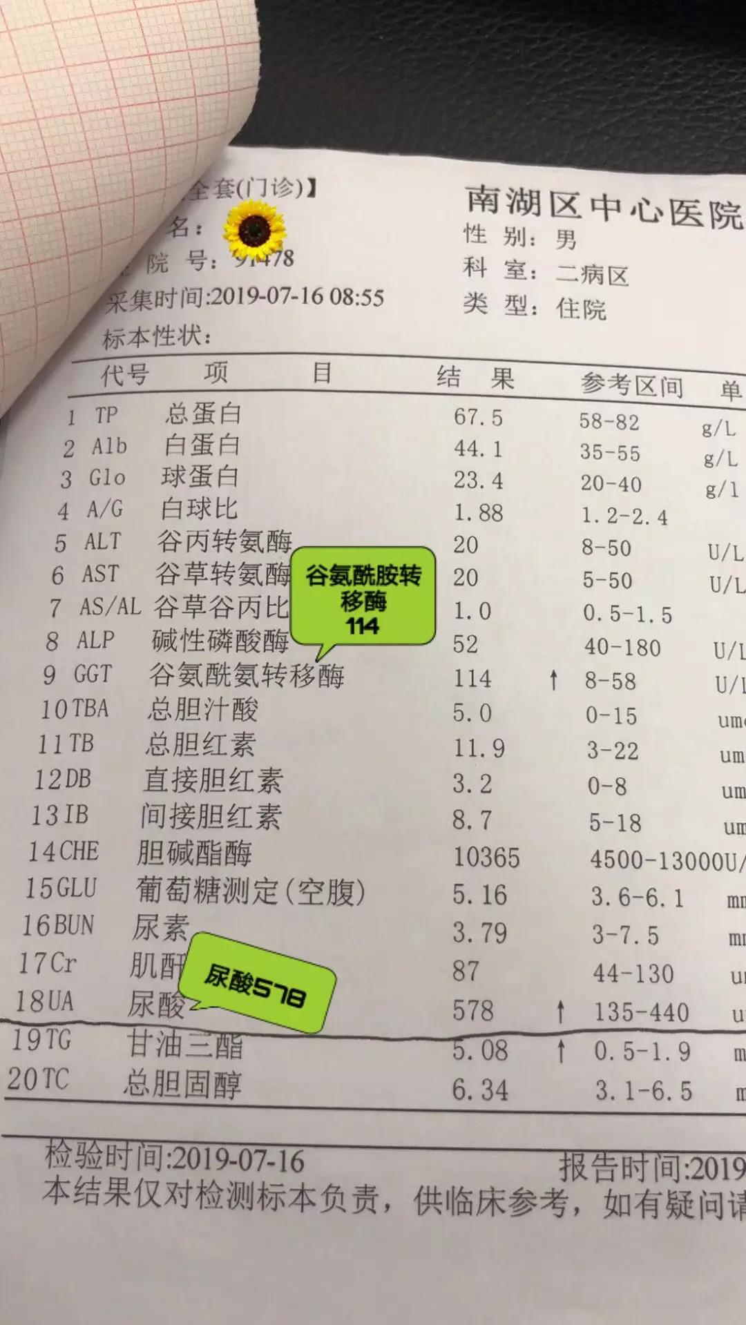 上面是肖先生使用产品前的化验单 使用之前,尿酸值是578μmol/l 谷氨